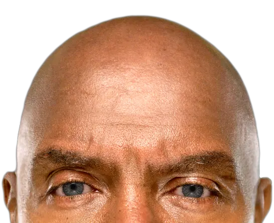 Close up of man's eye. Eye drops for dry eyes.